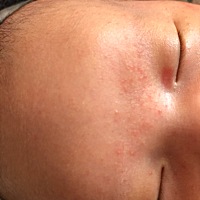 有哪位宝妈知道这是啥？以后会消下去吗？