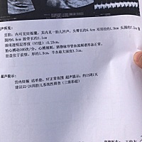 13周＋1的b超数据看得出来男女吗？