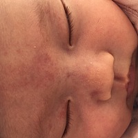 大家知道这些红红的是什么吗？生出来就有现在还没消