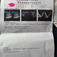 月经周期28天，2月26来的月经。3月4号结束。4月头去检查。2月3月都有同房。具体哪天怀孕的？