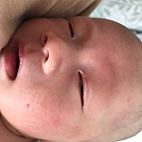 眼睛上眼皮有红点，大概一个月了还没有消，这是什么啊？