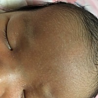 这是什么情况。额头全是这样的