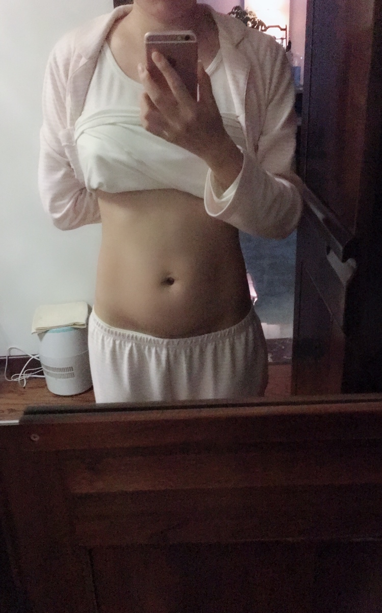 刨宫产术后20天！