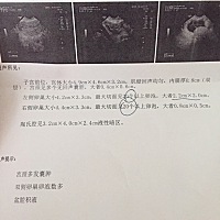 上个月吃了光克罗米芬测到强阳了也没怀，这个月吃的来曲唑跟滋肾育胎丸第18天了，始终没测到阳，做了个...