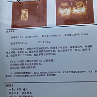 12周 又看得出是男孩还是女孩吗