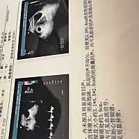 接到胎心胎芽喽，老夫的小心脏可以暂时消停会了