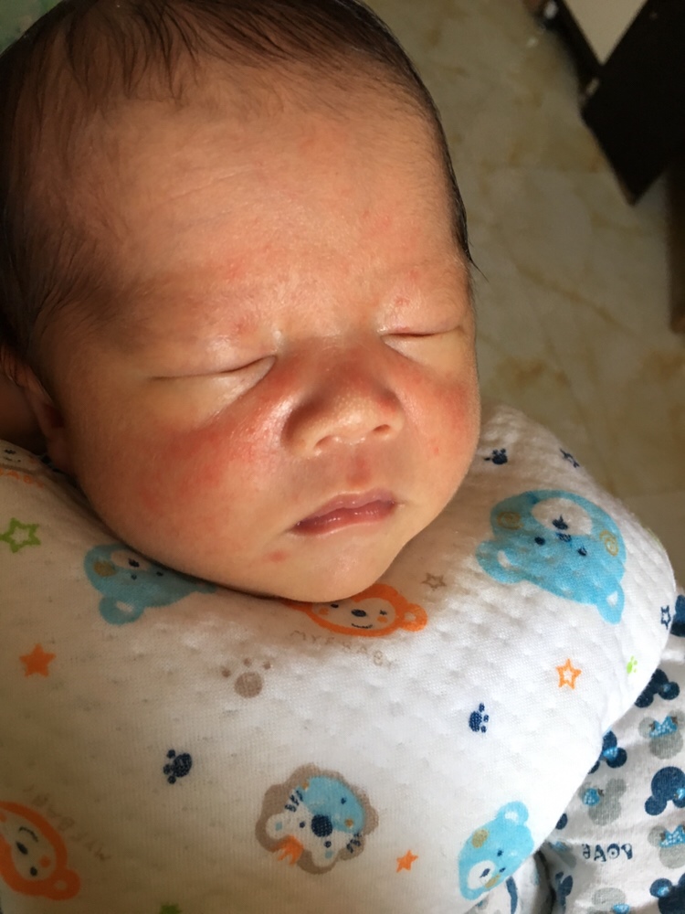 宝妈们看看这脸上长的什么东西啊