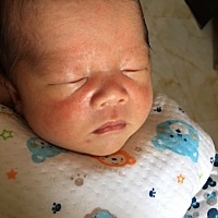 这是长的什么东西啊？ 宝妈们看看这脸上长的什么东西啊