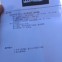 16周能看出来男孩还是女孩吗