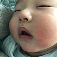 谁知道怎么回事儿，怎么能治好