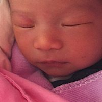 已经十几天了，眼皮上面红红的印子还没消，不知道是啥，出月去医院问问医生，操心