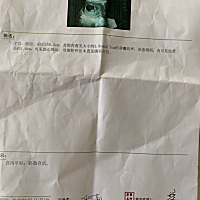 有谁知道这是男宝还是女宝