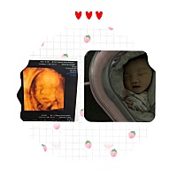 一个黄疸让小宝贝一个人在医院照蓝光，这让老母亲真的很忧伤。