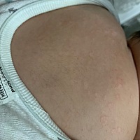 宝宝4个月了，今天突然发现宝宝背后，后肩部，长了很多红斑点，不是凸的，也不是痘痘，有宝妈姐妹知道这...