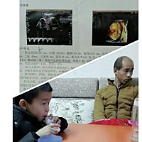 很像他爸，肯定是男孩。