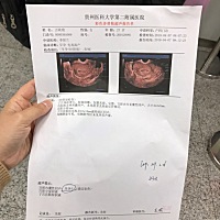 怀孕43天，大出血，B超检查看不到胎心胚芽，开了保胎药，吃一个礼拜保住了在复查