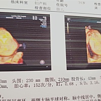 男孩👦女孩👧