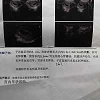 大神们快来帮看看是男是女呀🌸🌸