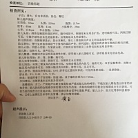 唐筛，nt 无创  四维通通过了。  等着明天的糖耐😁能帮忙看看是佩琪还是乔治吗？   纯属娱乐，