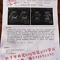 宝贝顺利出生了 开心 分享好孕了