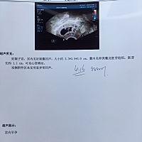 7周➕3天有胎心胎芽啦！开心