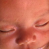 宝宝眼睛里老是进睫毛 有没有同款宝宝 宝妈们有什么办法可以弄出来吗🙏