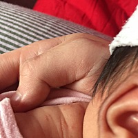 这个是不是着热到了？