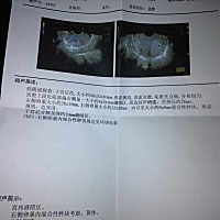 你们是怀孕还是没怀