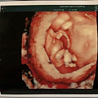 有懂的吗？帮忙看看是男是女