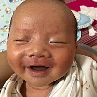 有哪位宝妈知道这是怎么回事？没喂母乳前脸还好好的，喂了母乳之后脸怎么变成这样了？