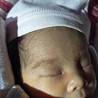 宝宝脸上水痘一样的东西，是热的吗？有经验宝妈告知一下，今天起床又长了好多，多数在发