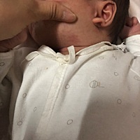 有谁知道这是什么吗？是胎记吗？从我肚子里出来就有。