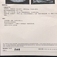 羊水中有光带回声 医生也不清楚是什么 严重吗