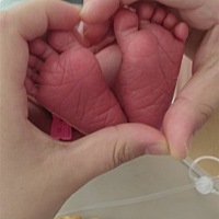 宝宝出生了！4月7号上午7：43剖腹产，横切 孕期宝宝臀位，双顶径10.3cm，羊水指数3.1cm 急诊剖宫产，430...