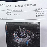 大家帮忙猜猜看，是佩琪还是乔治，哈哈