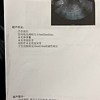 宫外孕四周，肚子痛，在县城医院照B说百分百确认宫外孕，立马来到省医院，照阴超，并没有看到？