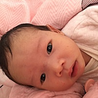 宝宝湿疹时候擦了三种药膏 现在湿疹好了但是脸变好黑😂有没有同样的问题宝妈 还会变白吗？