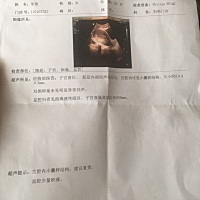 请问这个大概怀孕多久了