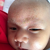 有宝妈知道这黄黄的疤怎么弄吗