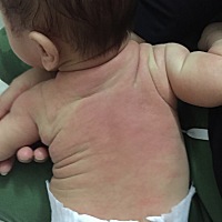 怪自己眼瞎呗，嫁了个不负责任的老公，宝宝后背不懂长的什么，从月子都现在擦药什么都不好，天气一热就...