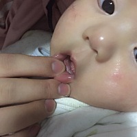 我家宝宝刚四个月就长牙，有这样的吗