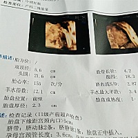 大家帮我猜猜是男孩还是女孩，出于好奇，