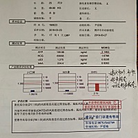 有没有宝妈遇到过这种情况，医生让过两个星期做四维的时候再看，好担心啊