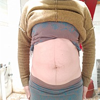 生完二胎肚子大的就像就像怀孕5个月，有没有宝妈和我一样