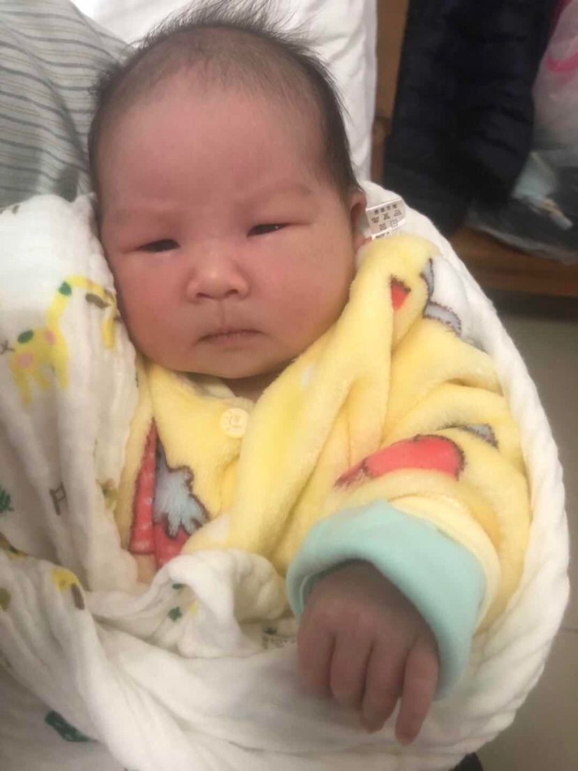 刚出生那会儿眼睛肿肿的