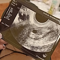 昨天去拍的 月份还小 还看不到胎心 医生说大概4周  跟我算的不太一样 过几天要再去看 希望一切顺利～