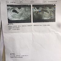 谁会看B超单？娱乐一下？看谁猜得准N&G？