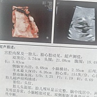 想给宝宝买衣服都不知道男女，今天想问，怕骂我就没有问。有会看的吗。我感觉应该是女宝宝。