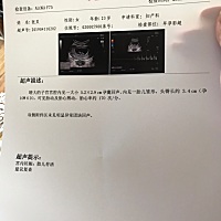 麻烦宝妈们有经验的帮我闺蜜看看，这个孕囊数值是怎么算的，我以前算我自己的是儿子，然后生出来是个儿...