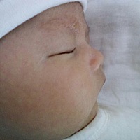 宝宝眉心上有黄色的一片一片的东西，那些是什么啊，擦了又没了，过会又有了